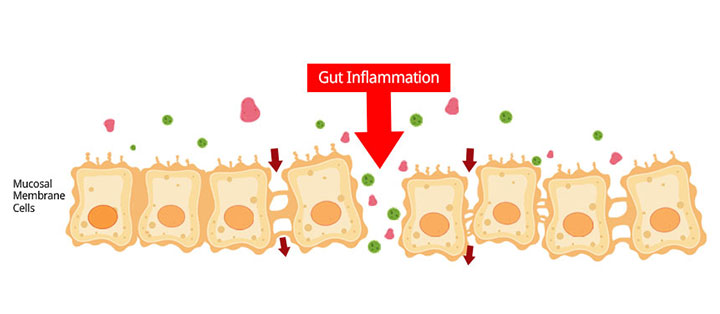 Mucosal membrane cells with gut inflammation